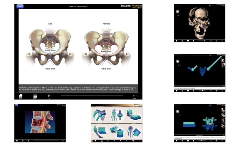 Skeleton Premium thumbnail 3