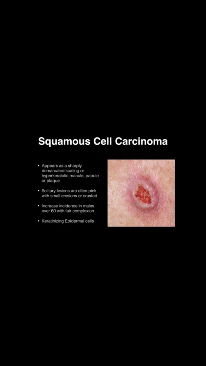Dermatology Blueprint PANCE Review Course screenshot-3