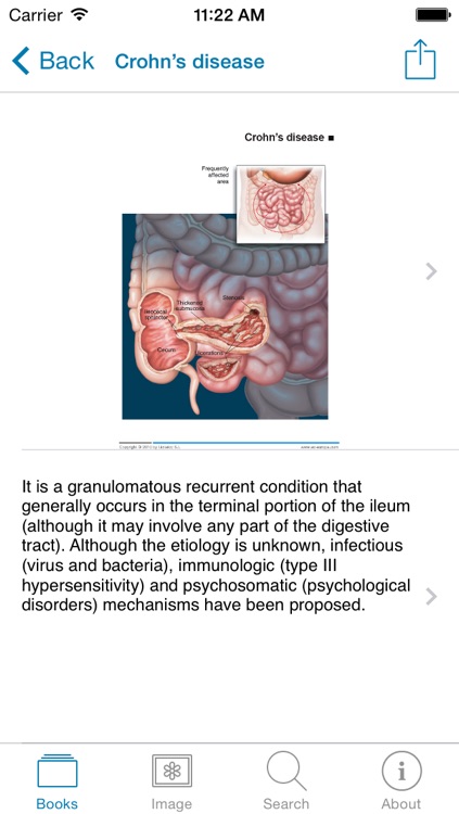 Miniatlas Gastroenterology screenshot-4