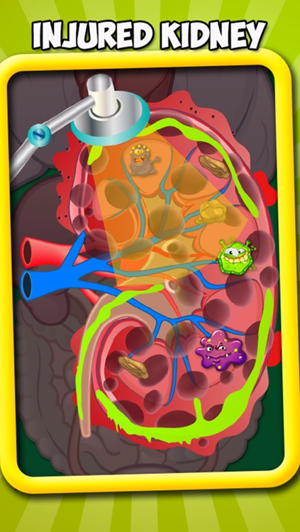Kidney Doctor – A free surgery game, Doctor games for kids, teens and girls, Fun and hospital game
