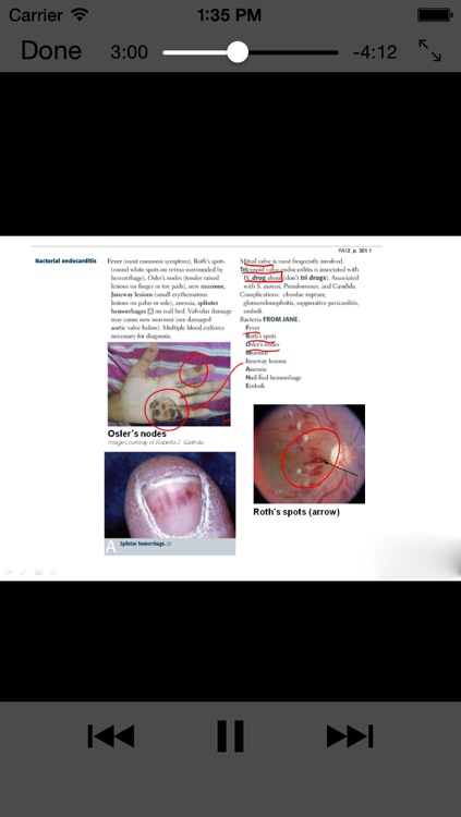 Learning USMLE