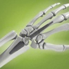 Motec Wrist Joint Prosthesis