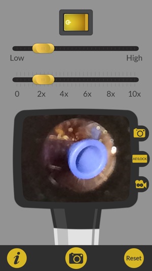 OtoscopeApp(圖1)-速報App