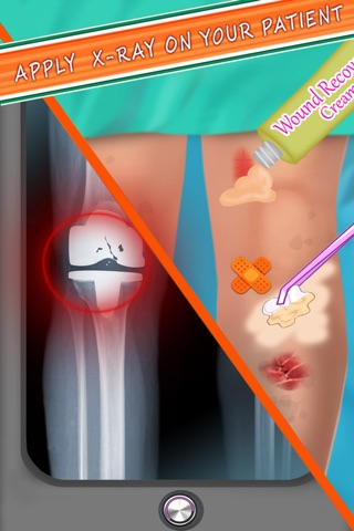 Knee Surgery Doctor screenshot 2