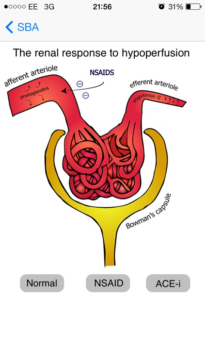 Medical SBA Questions (Finals/MRCP)