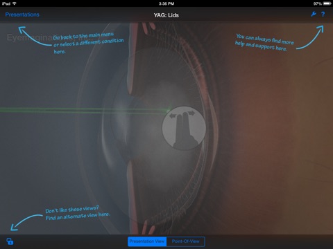 Echo IOL Simulator screenshot 3