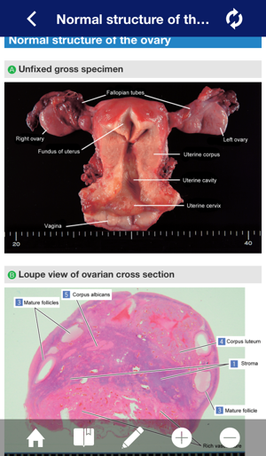 ATLAS OF PATHOLOGY And Comparison With Normal Anatomy(圖1)-速報App