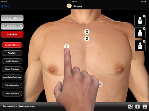 HEART MASTER Aortic Stenosis screenshot 3