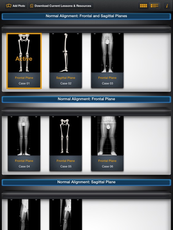 Bone Ninja