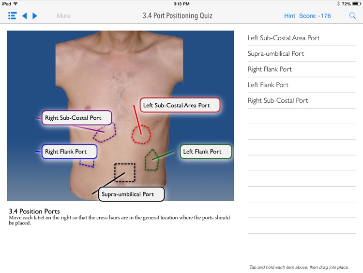 SimPraxis Lap Nissen Fundoplication Trainer