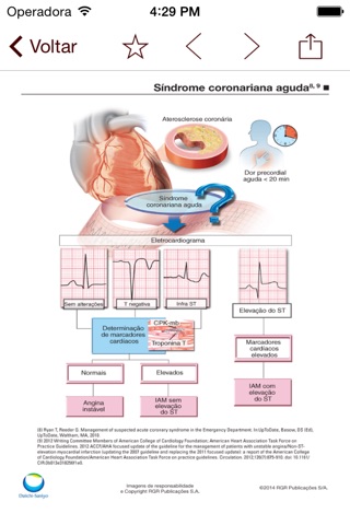 Síndrome Coronariana Aguda screenshot 3