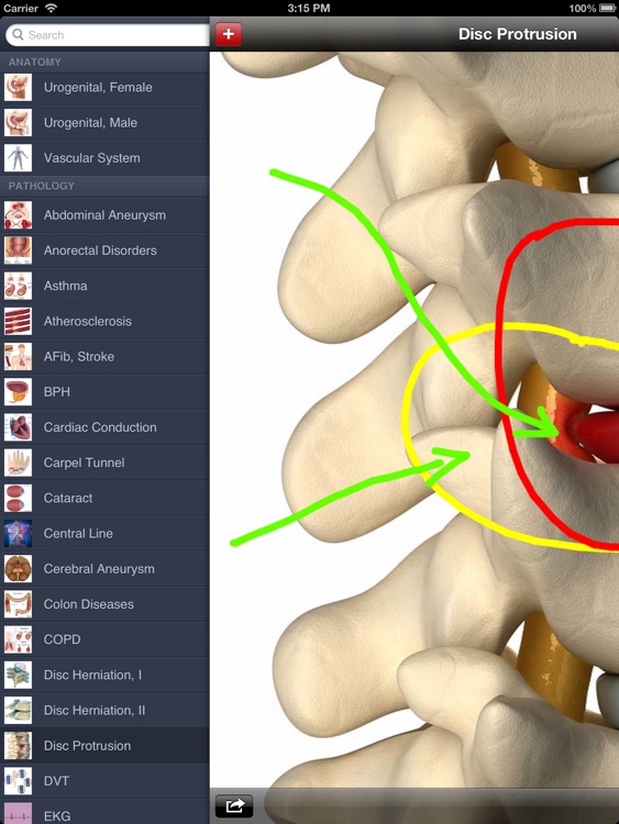 Med Sketch: Anatomy Drawing App for iPad