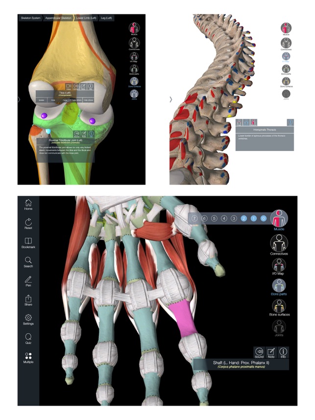 Essential Muscle + Skeleton Anatomy(圖5)-速報App