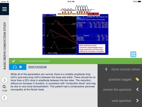 Learn EMG: An Interactive Quiz Approach to Electrodiagnostic Interpretation screenshot 4