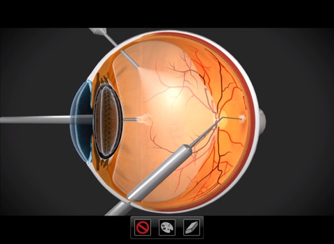 IMTouch Eye screenshot 2