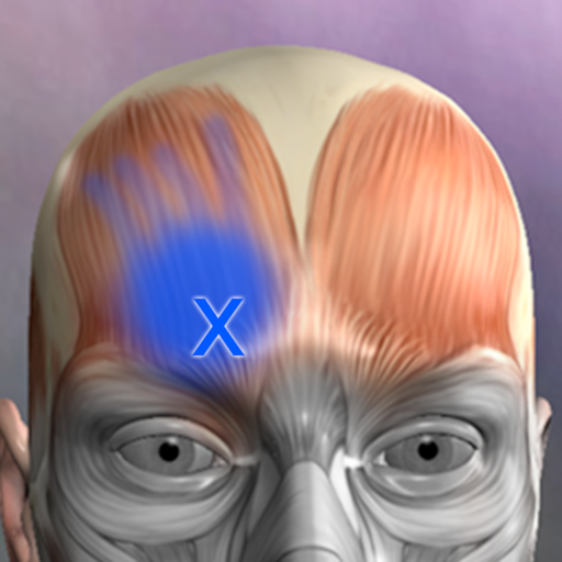 Muscle Trigger Point Anatomy