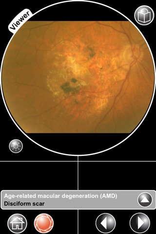 The Virtual Ophthalmoscope screenshot 2