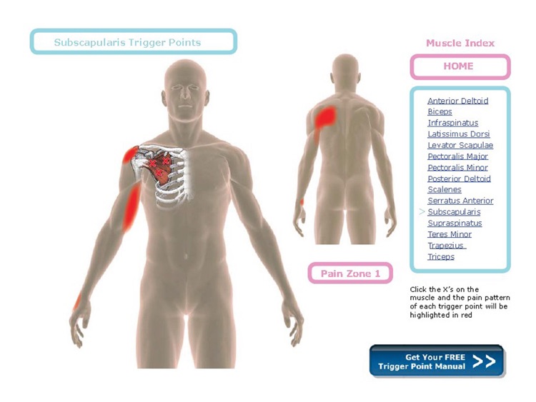 Trigger Point Charts Free