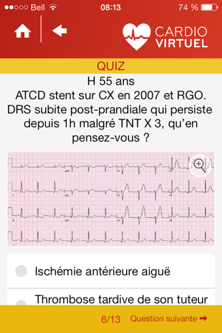 Cardio Virtuel présenté par des médecins spécialistes de l'Université Laval screenshot 2