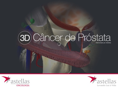Câncer de Próstata 3D screenshot 2