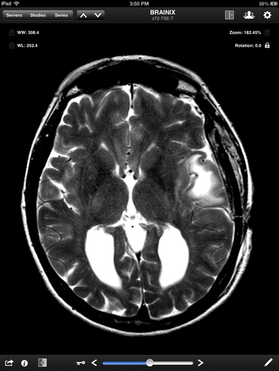 Jack Imaging Medical Image Viewer