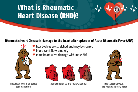 RHD Genetics - Menzies School Of Health Research screenshot 4