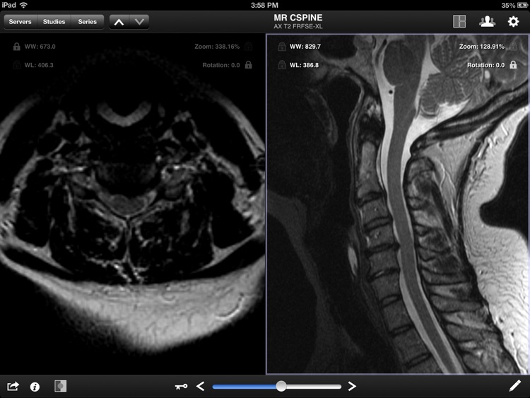 Jack Imaging Medical Image Viewer screenshot-3