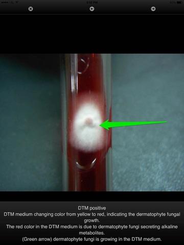 Dermatophytes Laboratory Quick Reference screenshot 3
