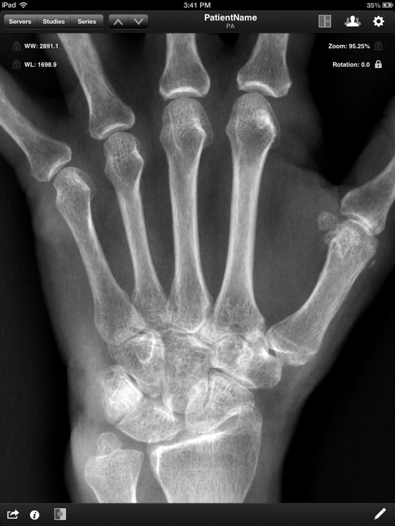 Jack Imaging Medical Image Viewer