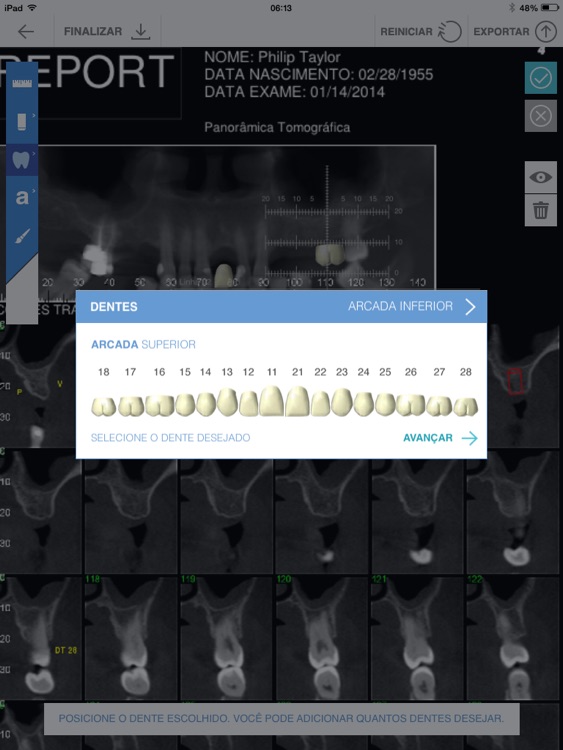 Implant for iPad screenshot-3