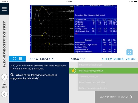 Learn EMG: An Interactive Quiz Approach to Electrodiagnostic Interpretation screenshot 3