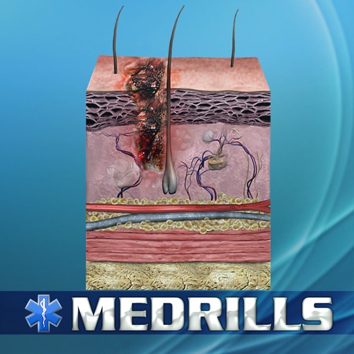 Medrills: Managing Soft-Tissue Trauma