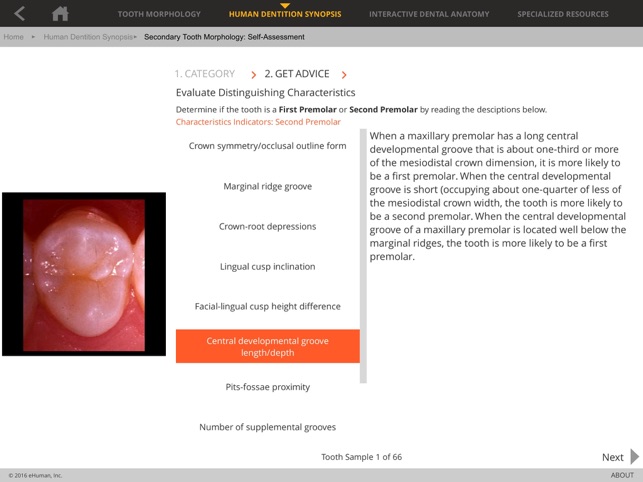 Tooth Atlas 8(圖4)-速報App