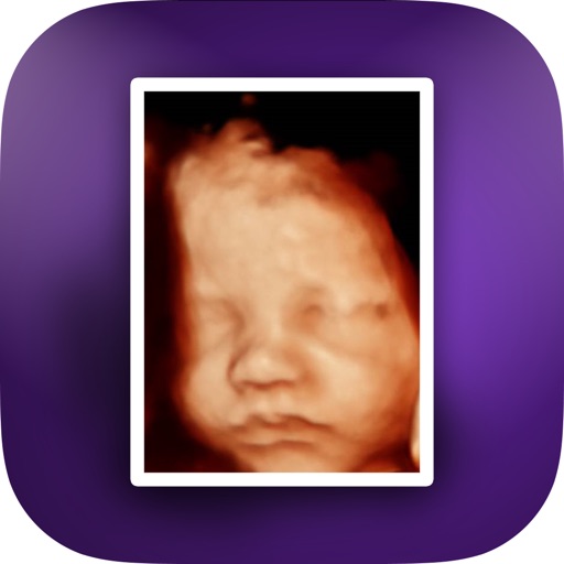 Your Baby Scan - Photo Locker iOS App
