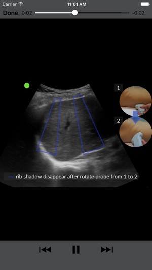 RESUS Ultrasound(圖3)-速報App