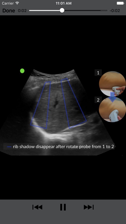 RESUS Ultrasound