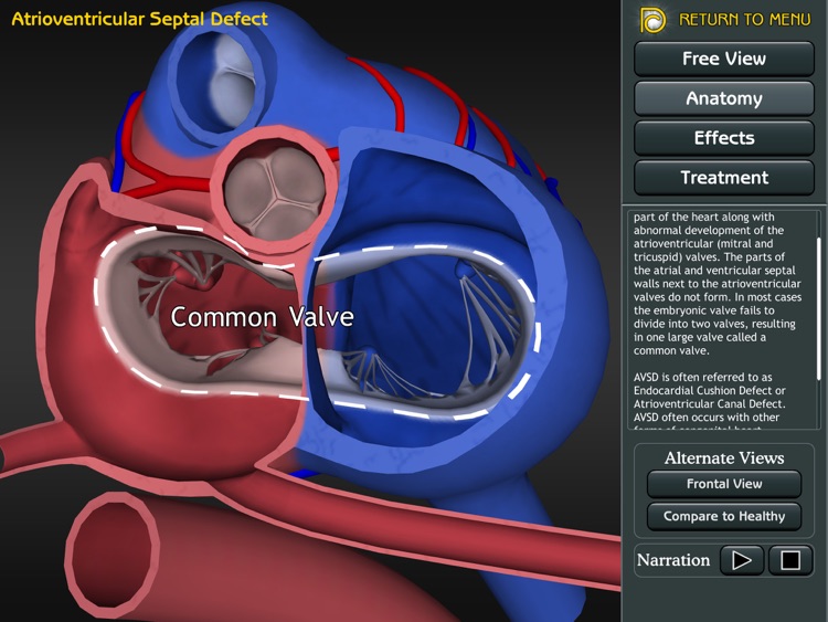 3D Road Map to Congenital Heart Disease