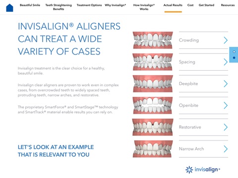 Invisalign Dentist Consultation App screenshot 4