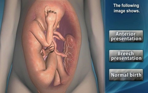Medrills: Obstetrical Emergencies screenshot 4
