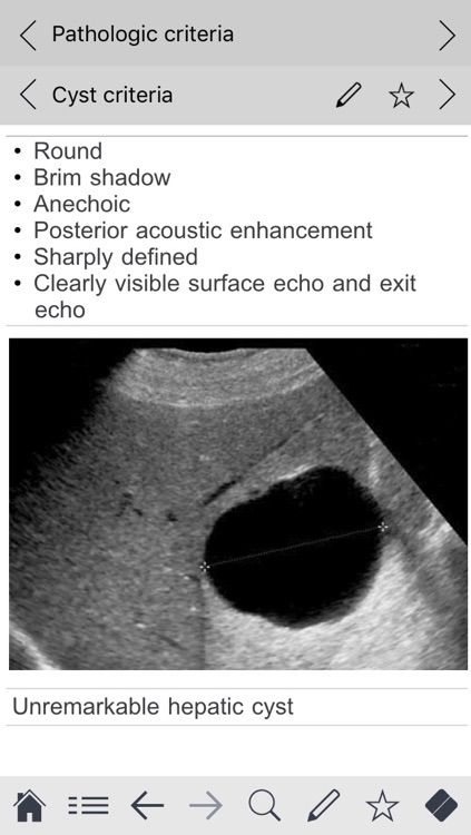 Abdominal ultrasound pocketcards screenshot-4