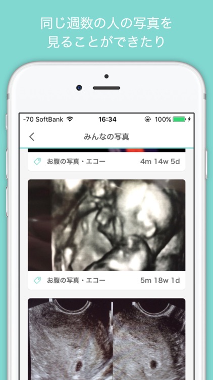 妊婦さんの為の妊娠応援アプリaomeey By Grappy