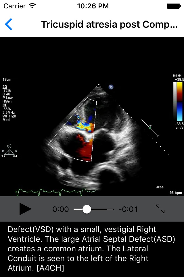 CARDIO3® Comprehensive Atlas of Echocardiography - Lite screenshot 4