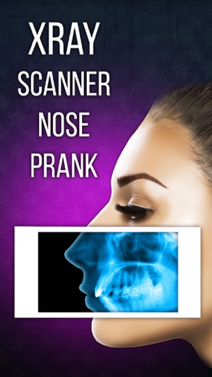 Xray Scanner Nose Prank(圖3)-速報App