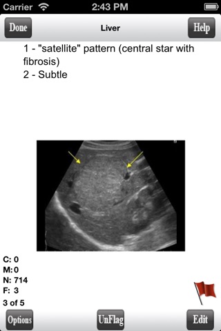 ARDMS Abdomen Ultrasound Flashcards for Boards screenshot 2