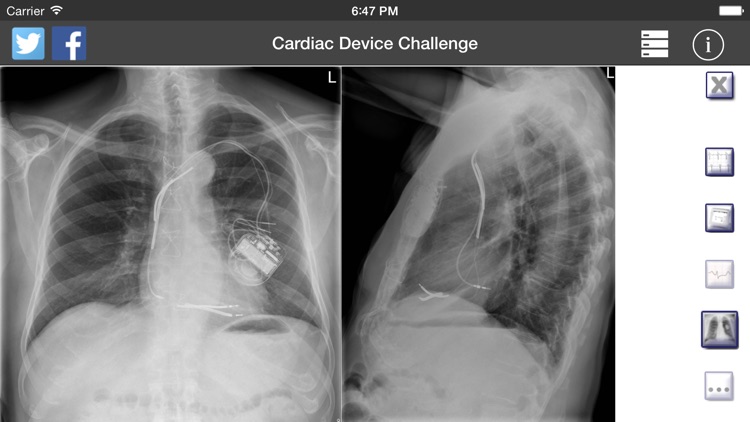 Cardiac Device Challenge PRO screenshot-3