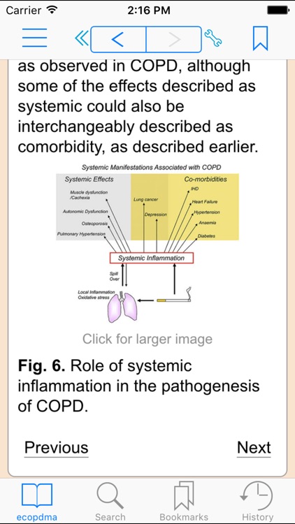 Chronic Obstructive Pulmonary Disease: A Multidisciplinary Approach, 1e (Clinics Collections)