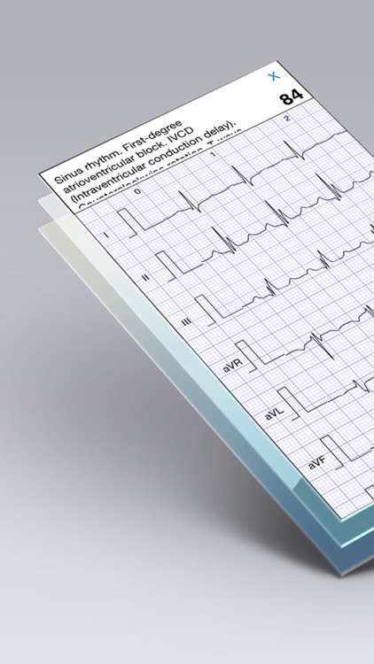 ECG Books - Cardiology Textbooks and Examples screenshot-3