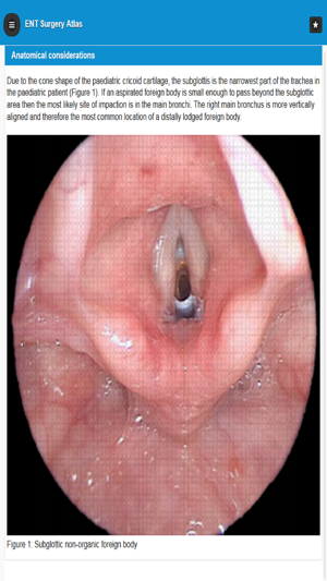 ENT Surgery Atlas(圖2)-速報App