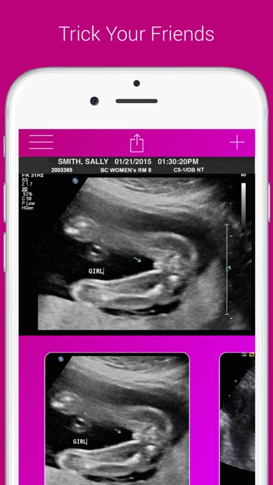 Ultrasound Prank Free - Pregnant Spoof And Fake Pregnancy Trick Screenshot on iOS