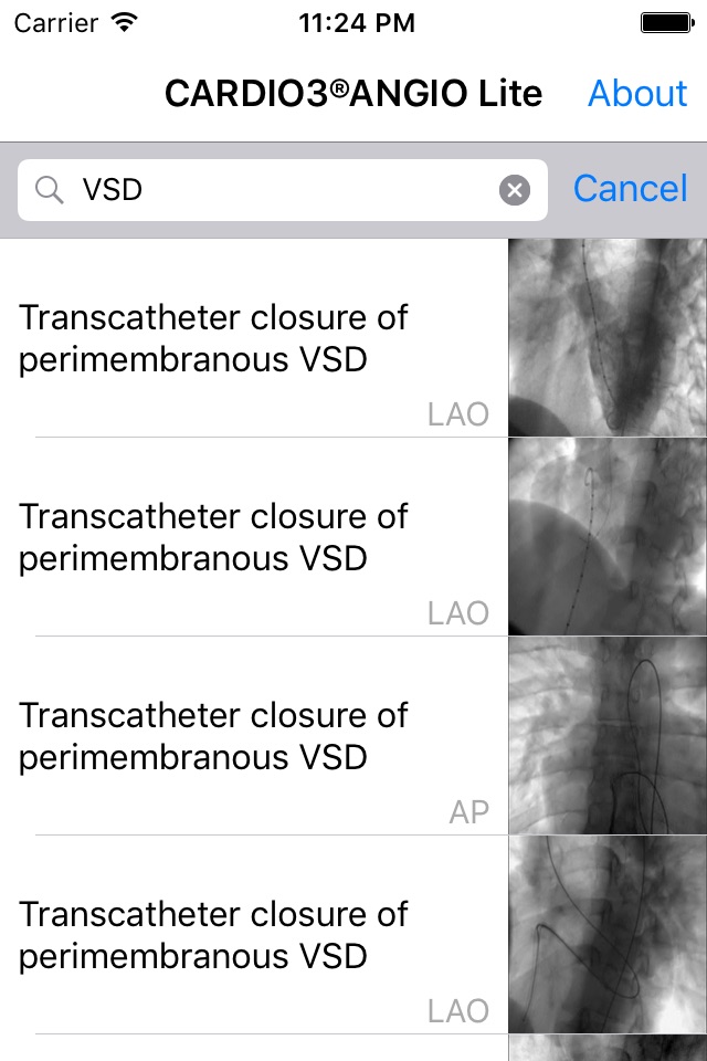 CARDIO3® Atlas of Interventional Cardiology – Lite screenshot 3